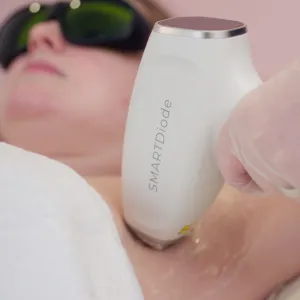 Laser Hair Removal (Micro Area)